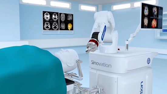 3D结构光神经外科手术机器人落户南溪山医院。南溪山医院供图