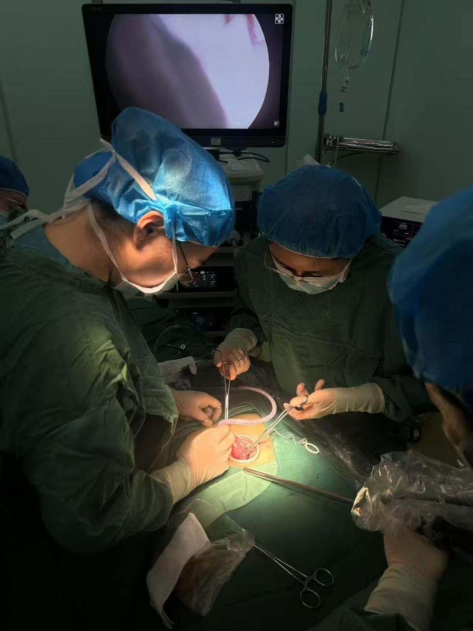 刘国艳（右）正在进行单孔腹腔镜下卵巢肿瘤剥除术带教